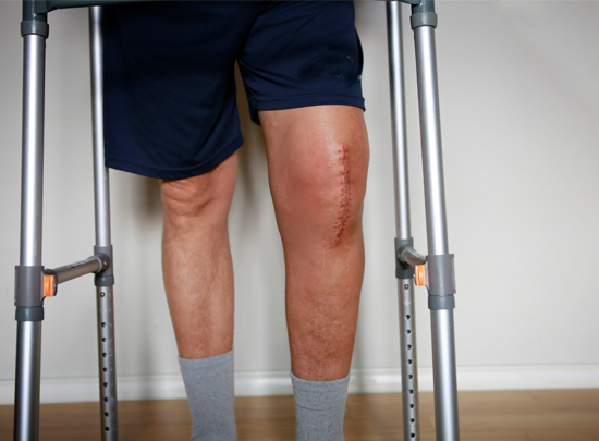 Orthopedic Rehabilitation from Elevate Physical Therapy